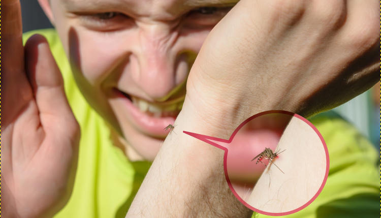 person being bitten by a mosquito - what attracts mosquitoes to humans